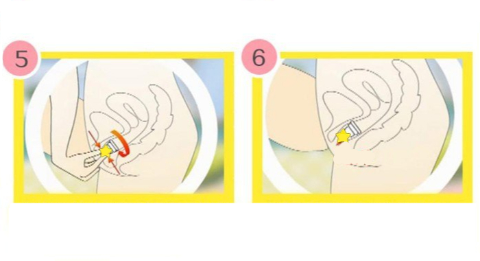 Copa Higiene femenina Silicona Medicinal Producto comprar sin plastico